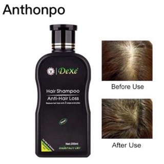 ORIG DEXE Organic Hair Grower Anti-Hair Loss Shampoo 200ML