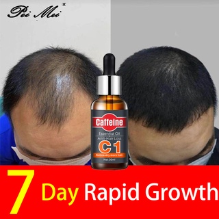 PEIMEI Caffeine Hair Growth Hair Grower for Men Original Hair Growth Serum