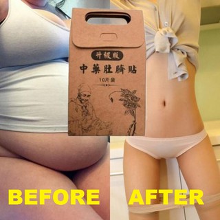 10PCS Slimming Patch Fast Effective Natural Chinese Herbal Weight Losing Fat Burning Detox (1)