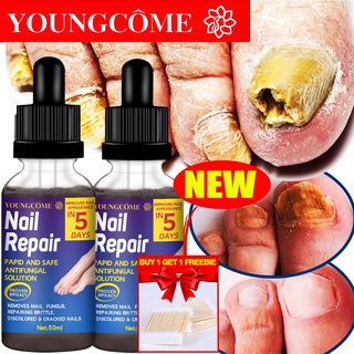 YOUNGCOME Nail Fungus Treatment Best Nail Repair Stop Fungal Growth Effective Fingernail Care