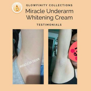 Glowfinity Miracle Underarm Whitening Cream 40g