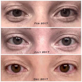 The ordinary Caffeine Solution 5%+ EGCG Eye Serum Eliminate Best Eye Cream Wrinkles Dark Circle 4Y1E (9)