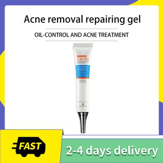 Freckle Cream Extract Acne Removal Scars Marks Treatment Facial Acne Cream Acne Marks Gel Essence Ac (1)