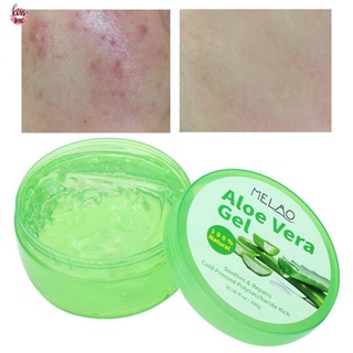 burst✻✷❀Meyis 300g Aloe Vera Gel Remove Pimples Shrink Pores After-Sun Repair Moisturizing Face Skin