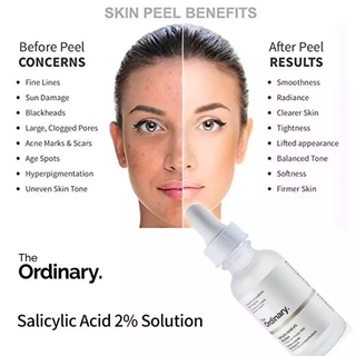 30ml The Ordinary Salicylic Acid 2% Solution Fast Effective Works on Acne Blemishes Facial Acid