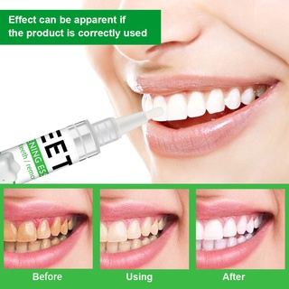 ♀◎❣Teeth whitening pen Effectively remove stains Whitening teeth Teeth cleaning tool (4)