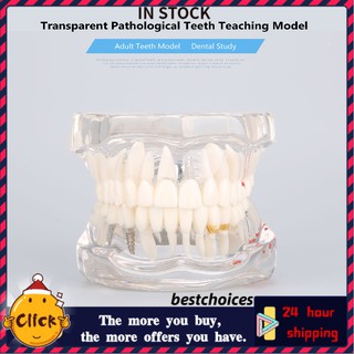 Dental Disease Teaching Study Adult Typodont Demonstration Teeth Model
