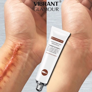 VG Scar Remover Acne Scar remover Cream Scars Repair Stretch Marks Pregnancy Scars Scalded (1)