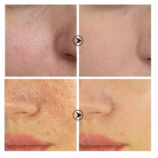 LANBENA Pore Treatment Serum Essence Shrink Pores 15ml (2)