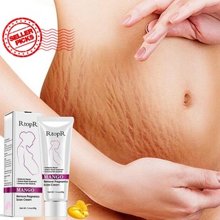 Rtopr Mango Remove Pregnancy Scars Acne Cream Stretch Mater Marks Treatment X4X5