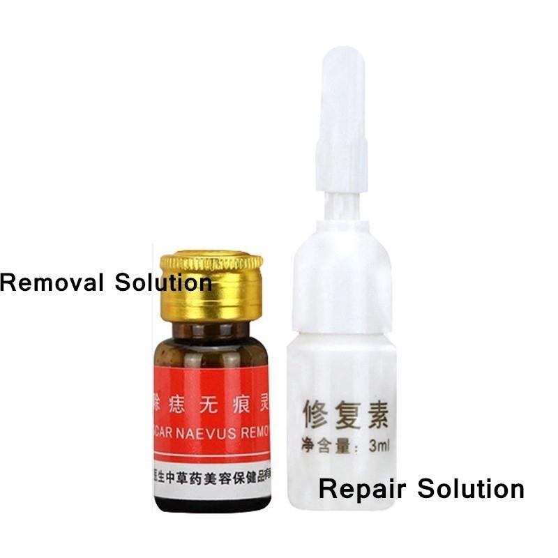 Painless Mole Wart Nevus Freckle Removal Solution Skin Care