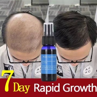 Hair Grower for Men Women Hair Treatment Hair Growth Spray Essence Hair Loss Preventing Baldness