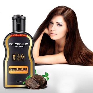 Hair Loss Treatment Shampoo Hair care Shampoo Hair Growth Anti-hair Loss Shampoo (4)