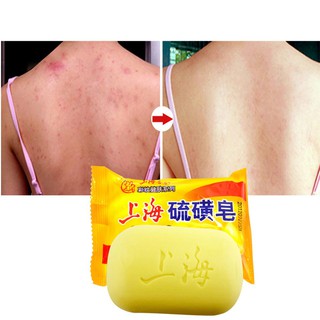 Shanghai Sulfur Soap Oil-Control Acne Treatment for Seborrhea Eczema Anti Fungal 85g