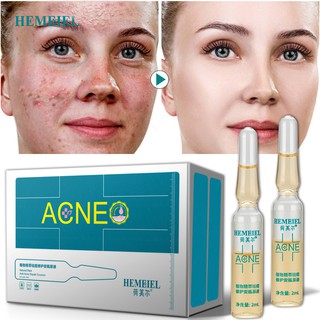 HEMEIEL - Anti Acne Serum,Scar Removal,Acne Pimple Treatment,Scar Repair,Sebum Control,Skin Care