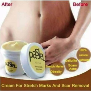 Uniheart Authentic PASJEL Stretchmark and Scar Remover Cream