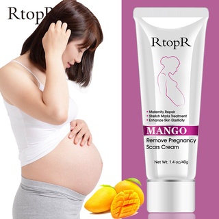 RTOPR Mango Remove Pregnancy Scars Acne Cream Stretch Marks Treatment Maternity Repair Anti-Aging An