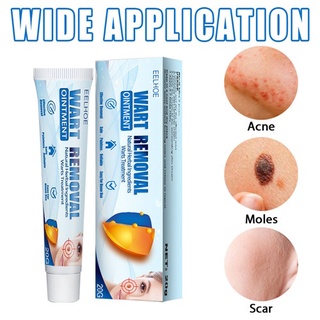 20g EELHOE Skin Tag Remover Wart Remover Ointment Wart Remover Cream Body Skin Tag Wart Removal Plaster for Men Women