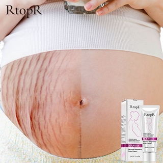 RtopR Mango Remove Pregnancy Scars Acne Cream Stretch Marks Treatment Maternity Repair Anti-Aging Anti-Winkles Firming Body Creams (2)