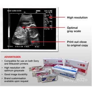 SONOMED Ultrasound Thermal Paper - Type 1 Standard grade (SM110S0