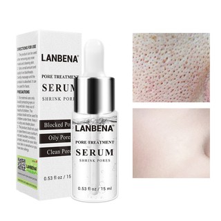LANBENA Pore Treatment Serum Shrink Pores Blackhead Remover (1)