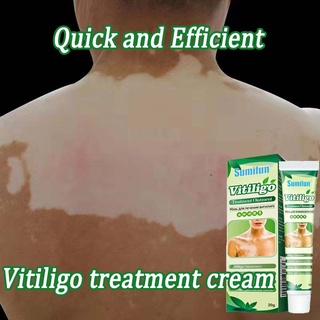 Vitiligo Leukoplakia Disease Treatment Ointment White Spot Disease Repair Cream Chinese Medical Pigm (1)