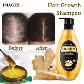 ginger shampoo hair growth refreshing oil control soft and nourishing scalp shampoo deep cleansing (1)