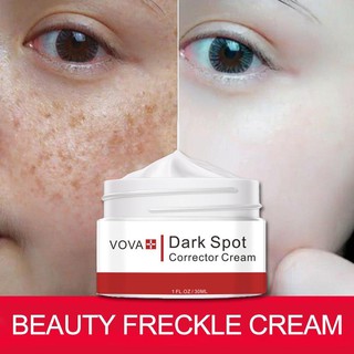 【spot goods】℗♨♤In Stock 30ml Effective Remove Melasma Acne Spot Pigment Melanin Dark Spots Pigmentat (1)