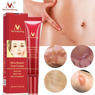 MeiYanQiong Scar Remover Gel Cream Scne Scar Stretch Mark Treatment Whitening Moisturizer Serum Skin Care 15g