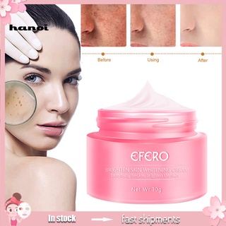HMB_ EFERO Dark Spot Speckle Freckle Removal Whitening Cream Face Care Skin Treatment