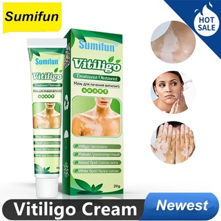 Sumifun 20g Chinese Herbal Vitiligo Leukoplakia Disease Treatment Ointment White Spot Disease Repair Cream Pigment Melanin Promoting Balm
