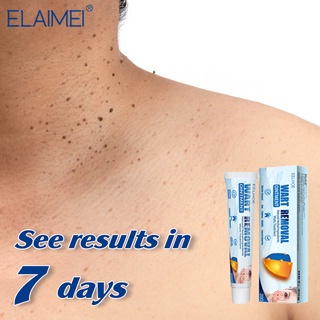 【EELHOE】Warts Remover Original Cream Skin Hyperplasia Kulugo Removal Effectively Warts Remover(20G) (1)