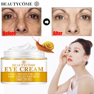 BEAUTYCOME Snail Eye Cream Anti Wrinkle Dark Circle Eye Bag Fade Fine Lines Remove Eye Repair Cream (1)