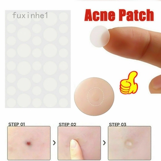 36pcs SKIN TAG REMOVER PATCH HYDROCOLLOID ACNE PIMPLES ZITS WARTS MOLES CARE BEAUTY