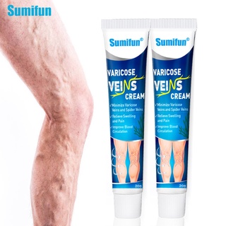 Varicose Vein Ointment Pain Relief Varicosity Angiitis Removal Leg Spider Treatment Cream 20g