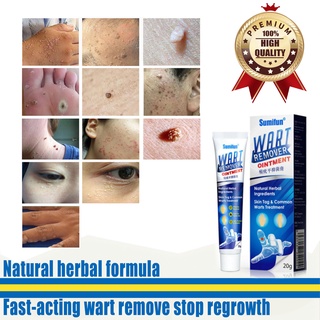 Warts Remover original Ointment Antibacterial face body acne treatment pimple remover cream herbal (2)
