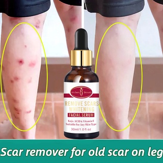 scar removal serum scar remover for legs Acne Treatment Anti Acne skin care old Scar Remover 30ml (1)