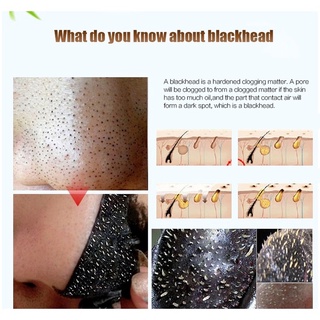 【spot goods】♂◙1 Pack Black Head Remover Mask Black Face Mask Acne Treatments Peel Off Black Mask Fro
