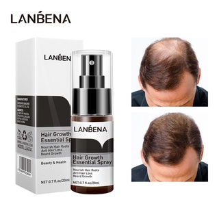LANBENA Fast Hair Growth Essence Spray Preventing Baldness Germinal Serum Anti Hair Loss Nourish