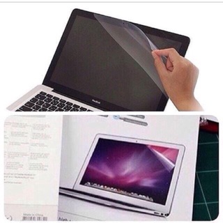 (FREE SHIPPING & COD) MacBook Screen Protector