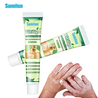 Sumifun White Spot Disease Treatment Ointment Leukoplakia Disease Repair Cream Vitiligo Pigment Melanin Skin Care Balm 20g