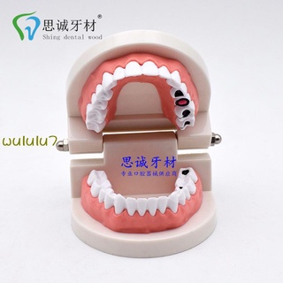 Teeth Model Teaching Model Dental Material Oral Material Denture Model Oral (3)