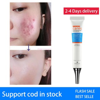 Acne scar removal Freckle Cream Extract Scars Marks Treatment Facial Acne Cream (1)