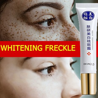 Whitening freckle Remove spots Cream melasma removal cream original Whitening freckle Cream dark spo