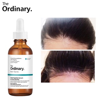 The Ordinary Hair Growth Essence Promotes Hair Grower Anti Hair Loss Treatment Serum Hair Care oil