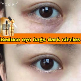 Yoxier Circles Under Eye Cream 10ml Against Puffiness Remove Eye Bags/Eye Serum/Anti-Wrinkle