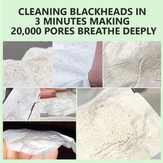 Herbal Blackhead Remover Set Whiteheads Blackheads Mask Nose Strip Pore Minimizer Serum Deep Clean (4)