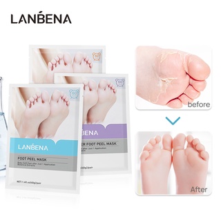 LANBENA Foot Mask Exfoliating Remove Dead Skin Foot Care Body Care Scrub Whitening Peeling Mix Set
