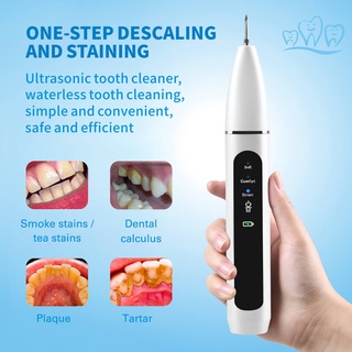 Ultrasonic Dental Scaling Tooth Calculus Remover Dental Scaler for Teeth Cleaner Electric Sonic Stai (1)