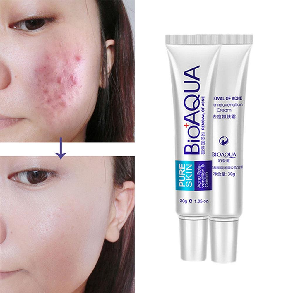 Natural Scars Removal Gel Spots Acne Repair Treatment
